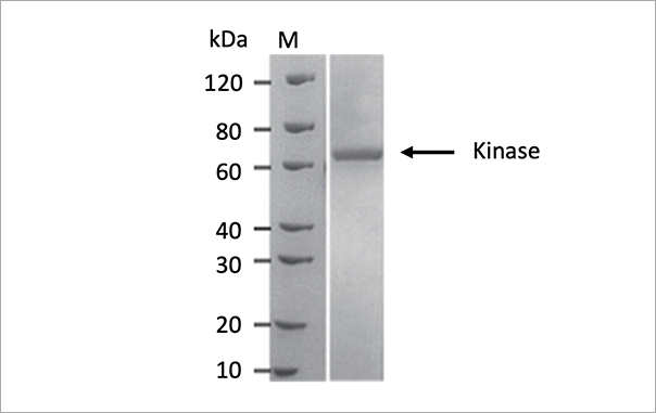 Sf9细胞成功表达Kinase，纯度95%，表达量10mg/L